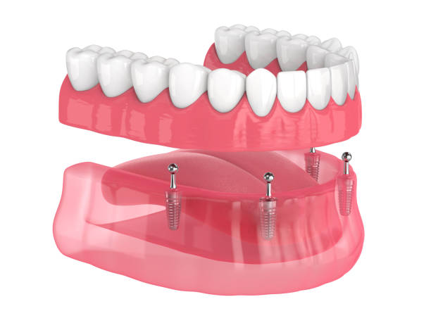 dentures in Stamford CT